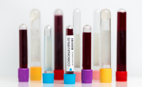 Coronav&iacute;rus: impacto direto nas estrat&eacute;gias de comunica&ccedil;&atilde;o 