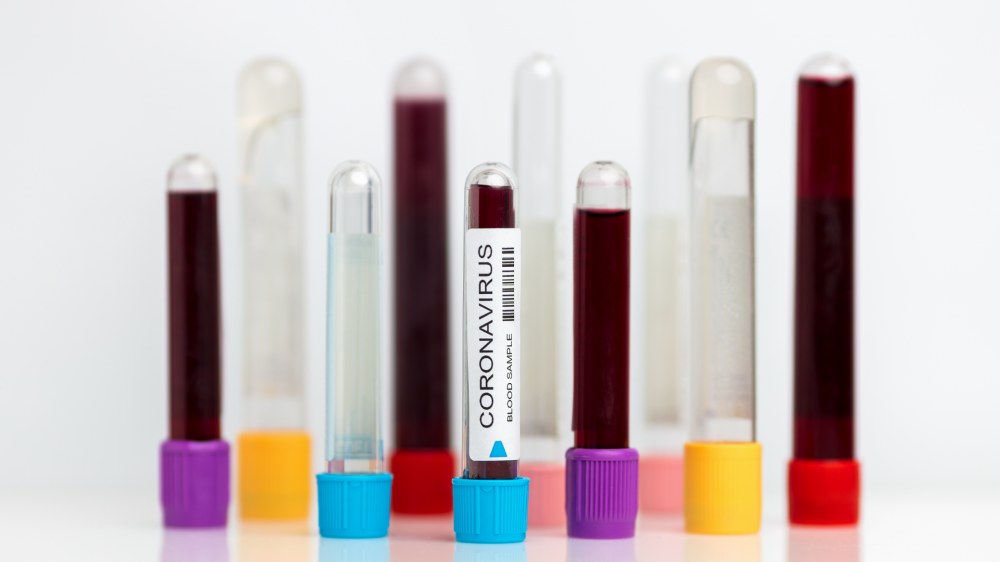 Coronav&iacute;rus: impacto direto nas estrat&eacute;gias de comunica&ccedil;&atilde;o 